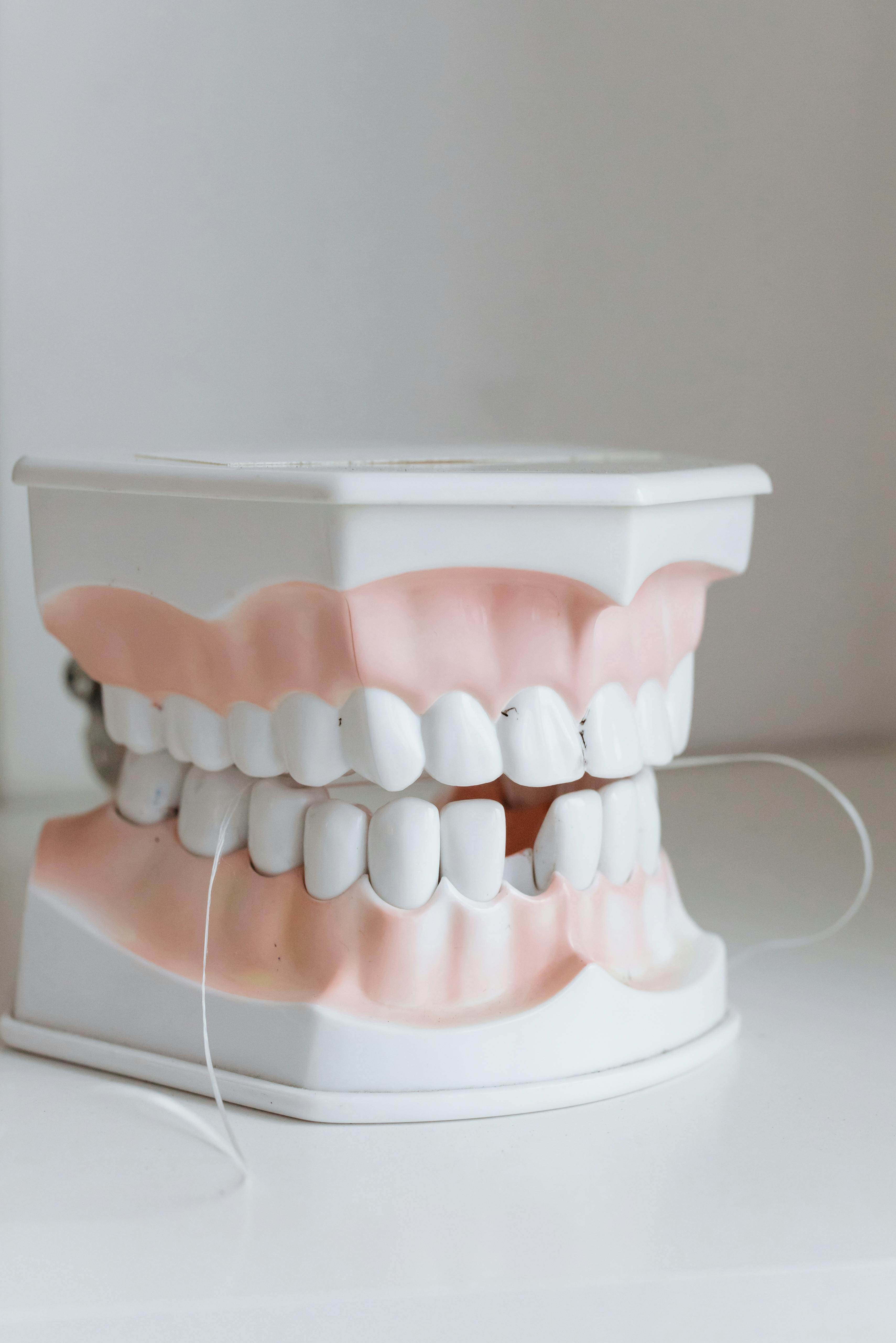 Modelo dental - DentalCare